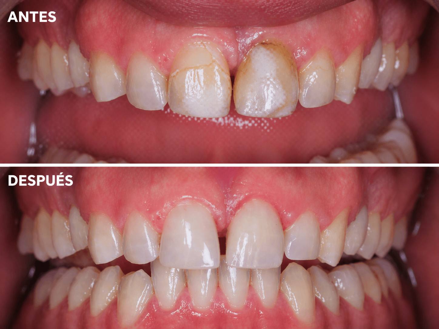 Antes y Después - Caso 9